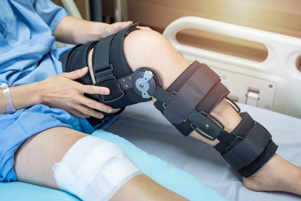 what-is-the-average-acl-injury-recovery-time-after-a-surgery