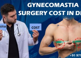 Gynecomastia surgery cost: Decoding cost and considerations